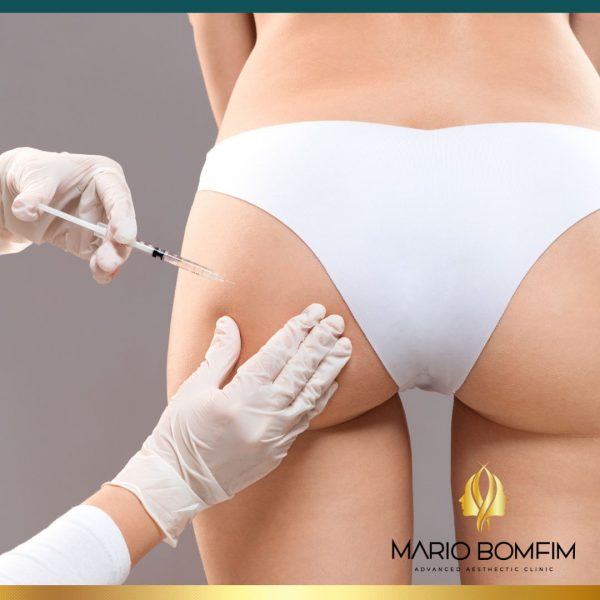 BRAZILIAN BUTT LIFT INJECTABLE